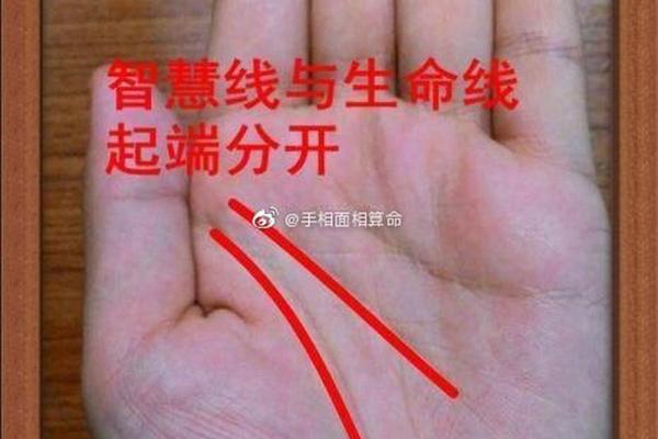 食指上的黑点代表什么？揭开命理学中的秘密！