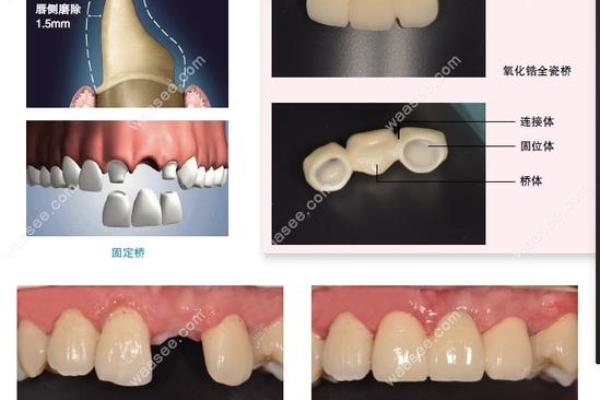 揭开牙齿的秘密：十八颗牙齿的命运与人生哲学