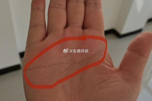 探秘手相线断裂：命运的波折与转机